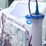 Yobe Government Invests N360 Million Annually in Free Kidney Dialysis