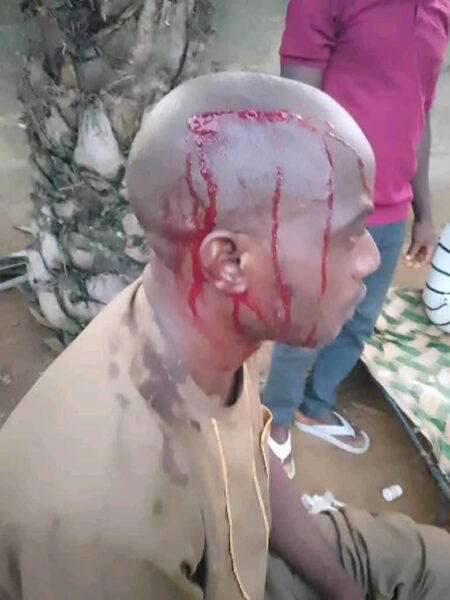 Attack on Hon. Datu Daniel’s personal assistant draws outrage, raises questions over growing political violence at grassroots level
