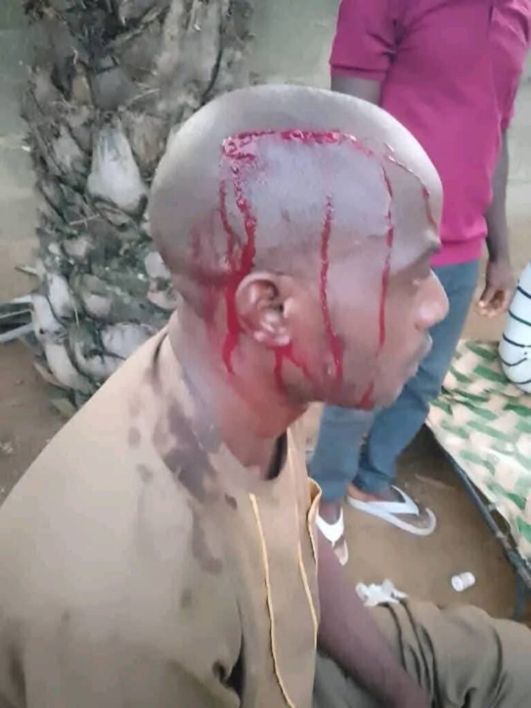 Attack on Hon. Datu Daniel’s personal assistant draws outrage, raises questions over growing political violence at grassroots level